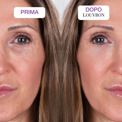 Maschera PDRN Collagene Caviale Box x4