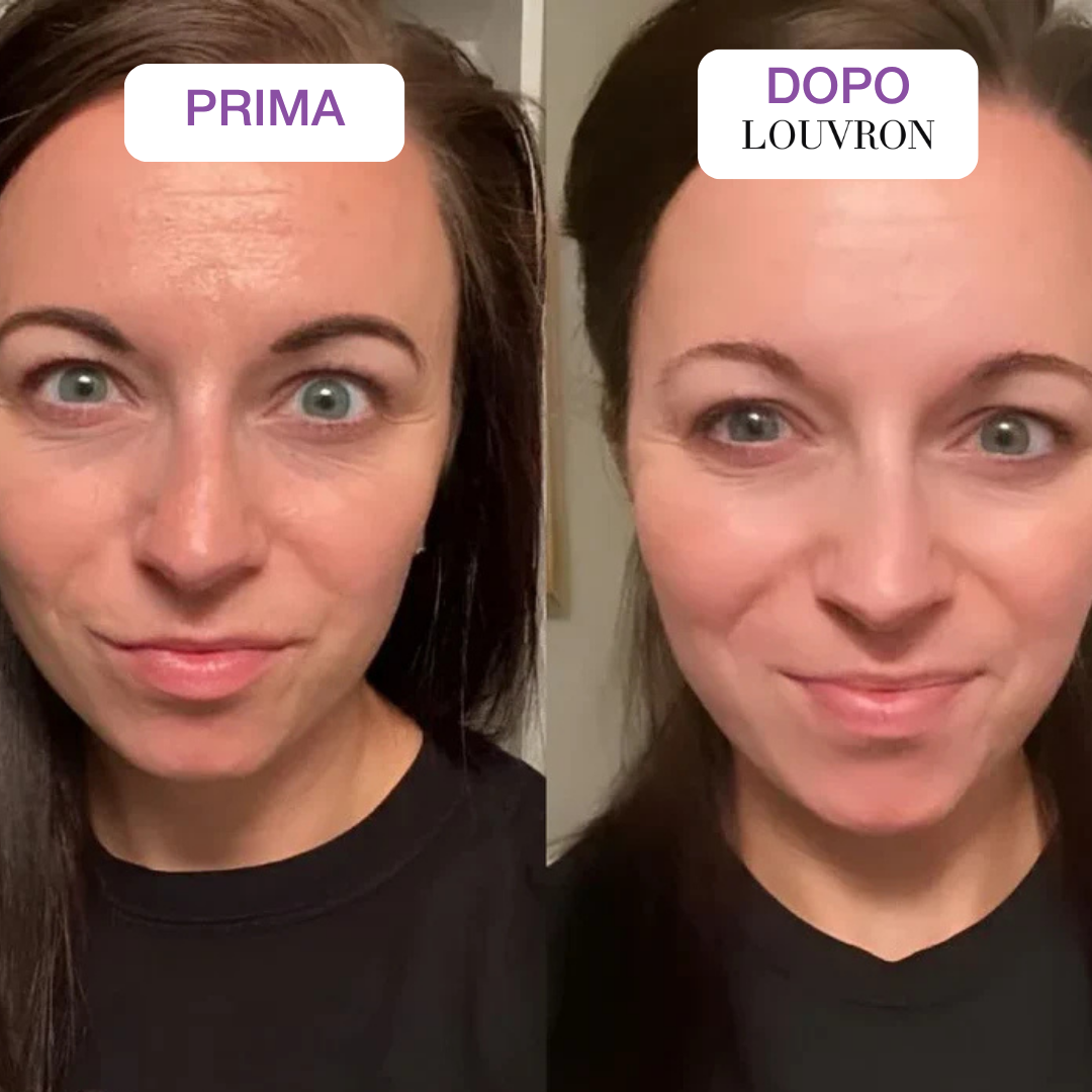 Maschera PDRN Collagene Caviale Box x4