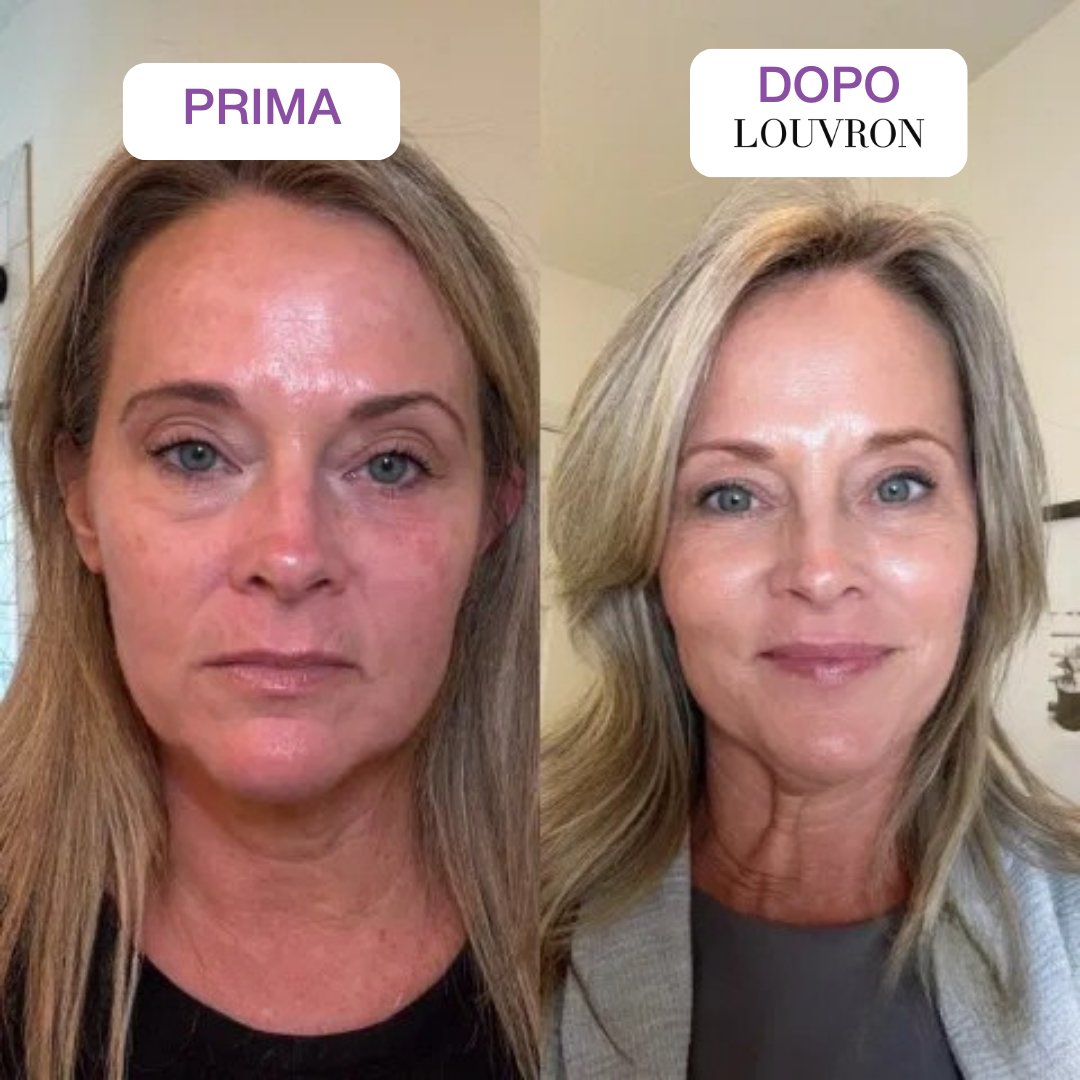 Retinal Booster Anti-Età